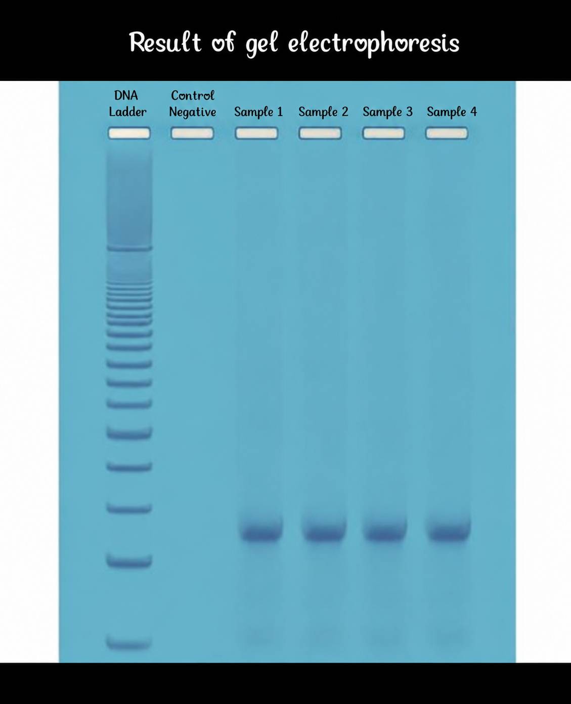 Result of gel electrophoresis